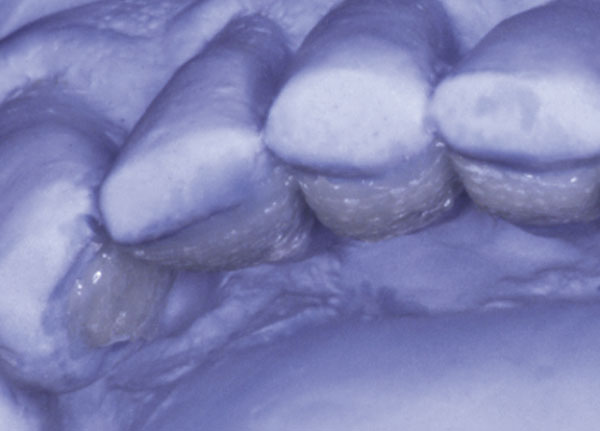 The interlocking fibers in the leno weave provide multi-directional stability by transferring stresses throughout the fiber network.