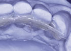 StickTech products have severe memory problems, are difficult to adapt, and are not as durable as Ribbond.