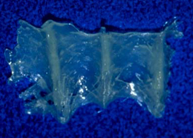 Competitor's braided weave