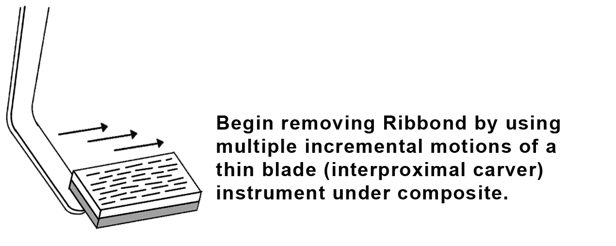 Place Flowable Composite