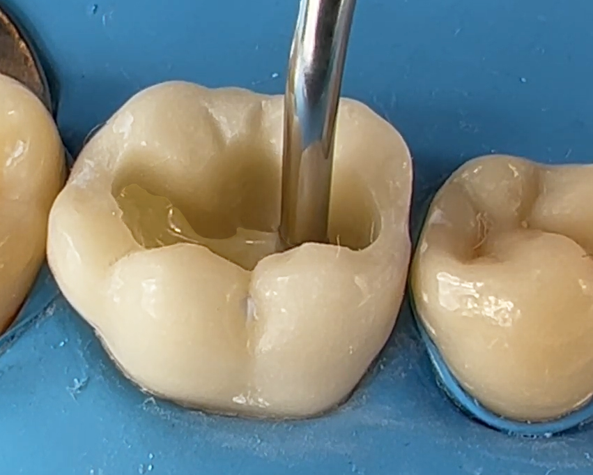 Place Flowable Composite