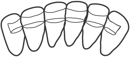 Optional preparation